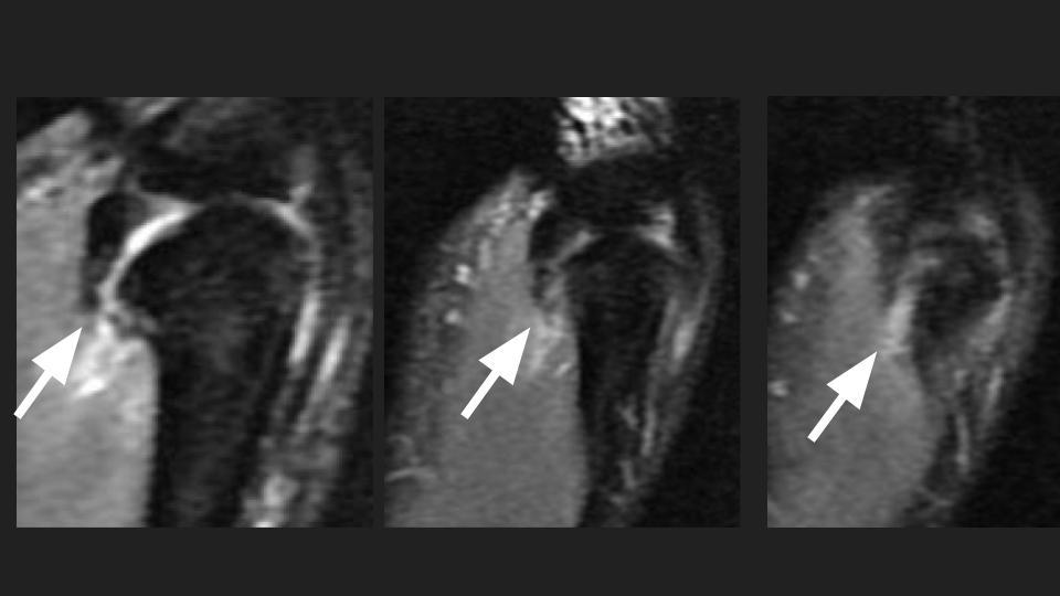 Figure 4 for case sprain ( RID4731 )